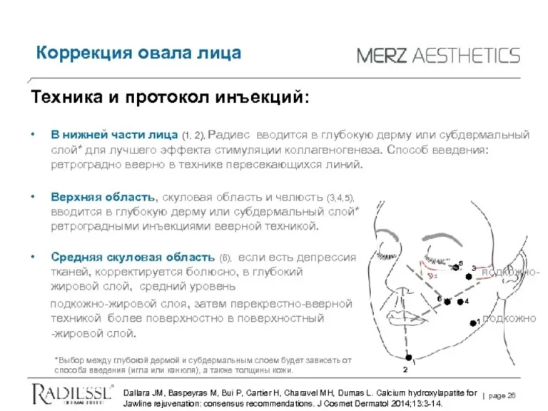 Точки профайло схема лицо